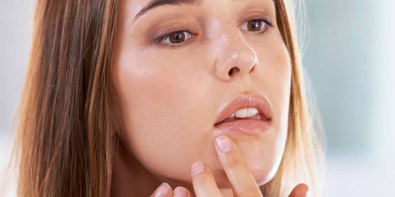 Brufoli (o acne): cosa sono, sintomi, perché viene, cura, rimedi