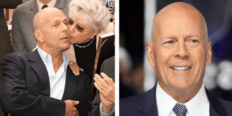 La mamma di Bruce Willis: Mio figlio ormai non mi riconosce più ed è diventato aggressivo