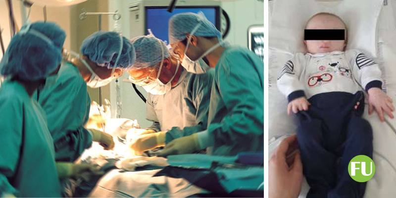 I medici di Torino hanno operato con successo un bambino il cui cervello scendeva attraverso il naso